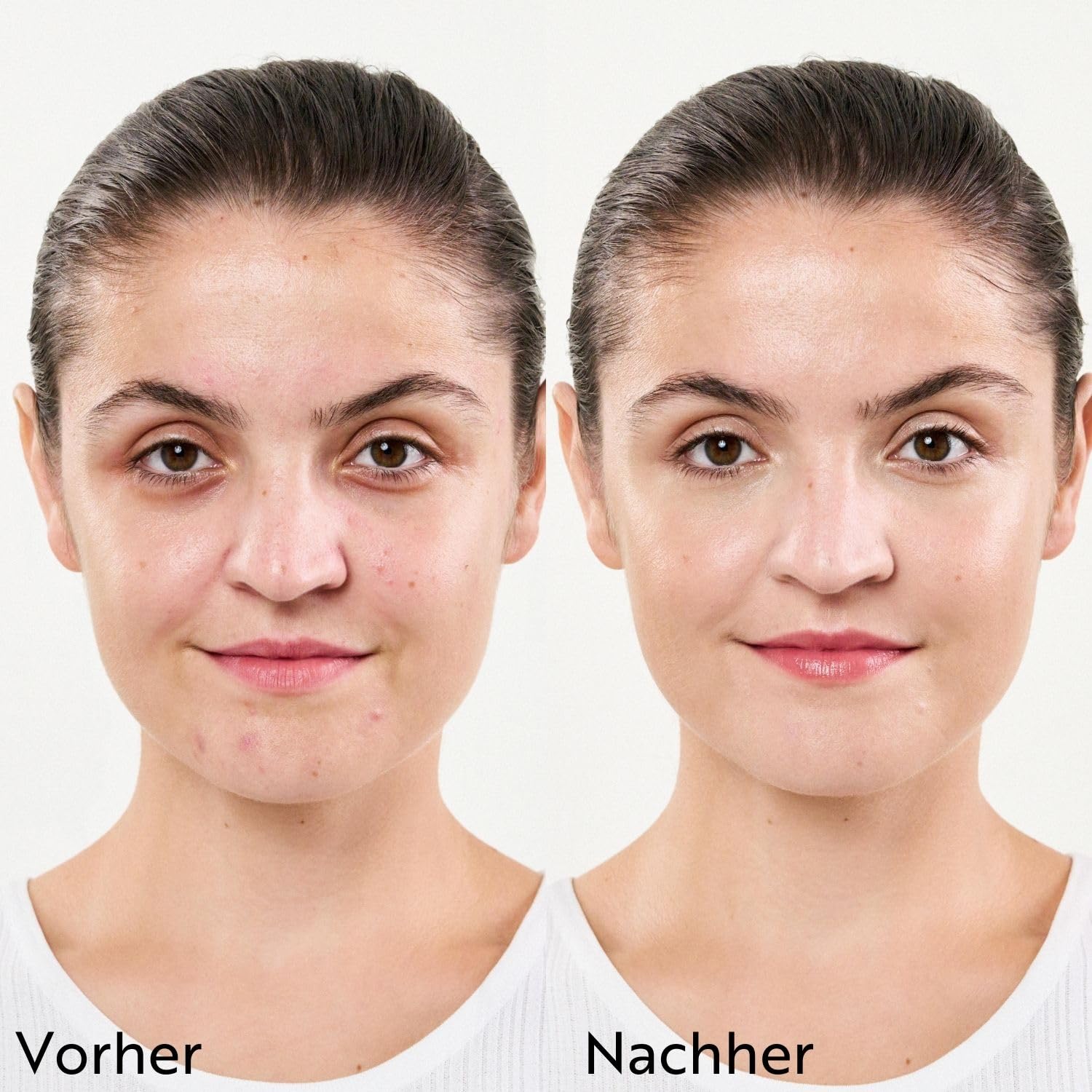 m-asam-clear-skin-discovery-set-4-teilig-unreine-haut image 7