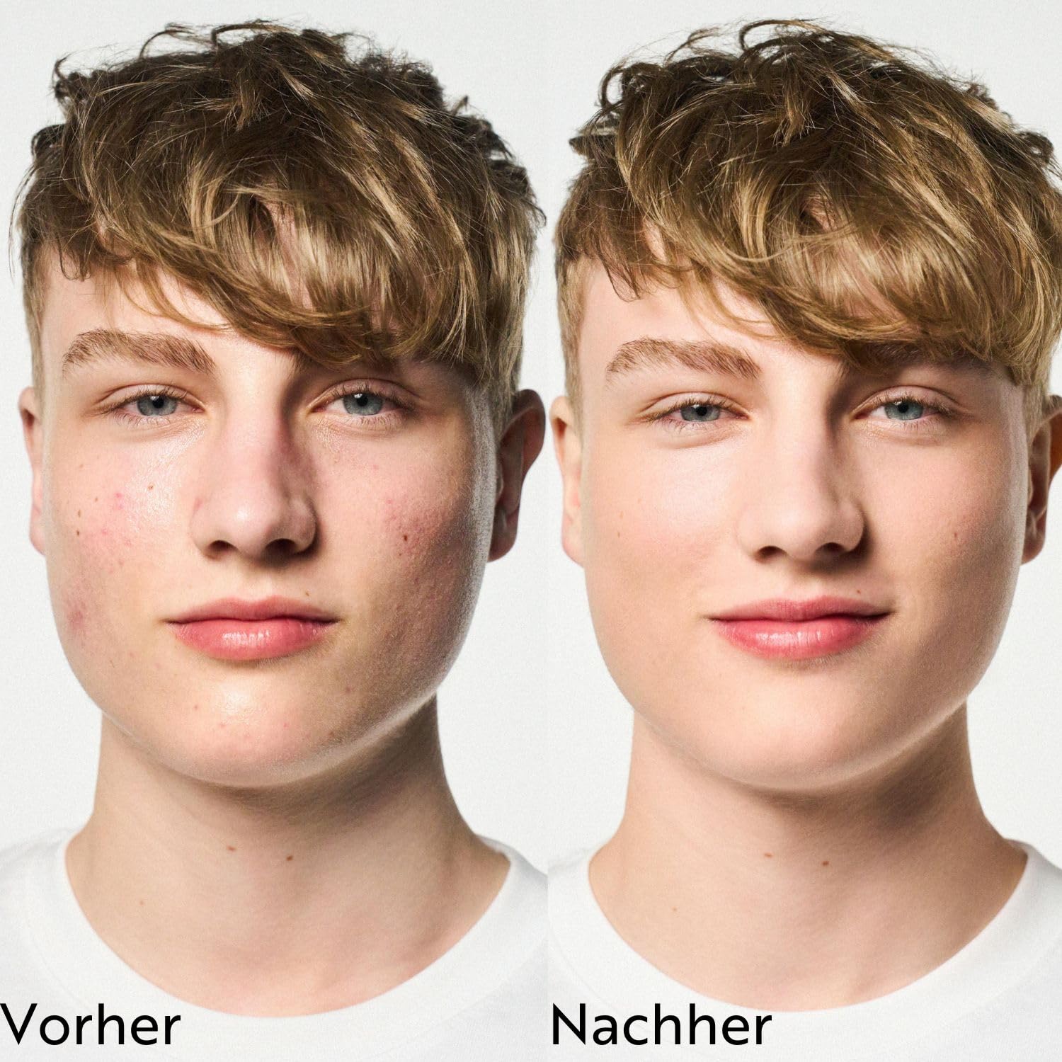 m-asam-clear-skin-discovery-set-4-teilig-unreine-haut image 5