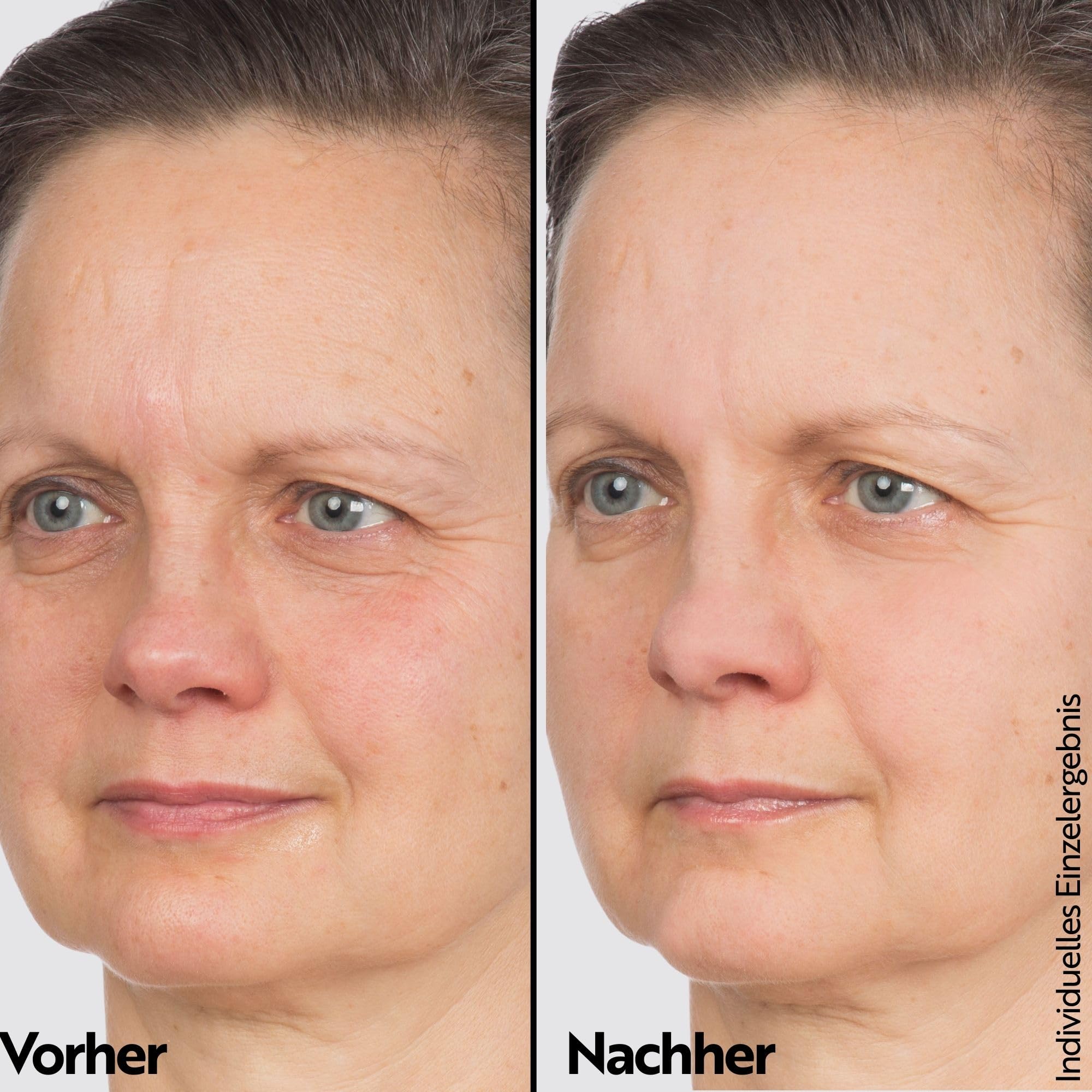 m-asam-vinolift-overnight-lift-peptide-essence-gesichtsserum-50ml image 5