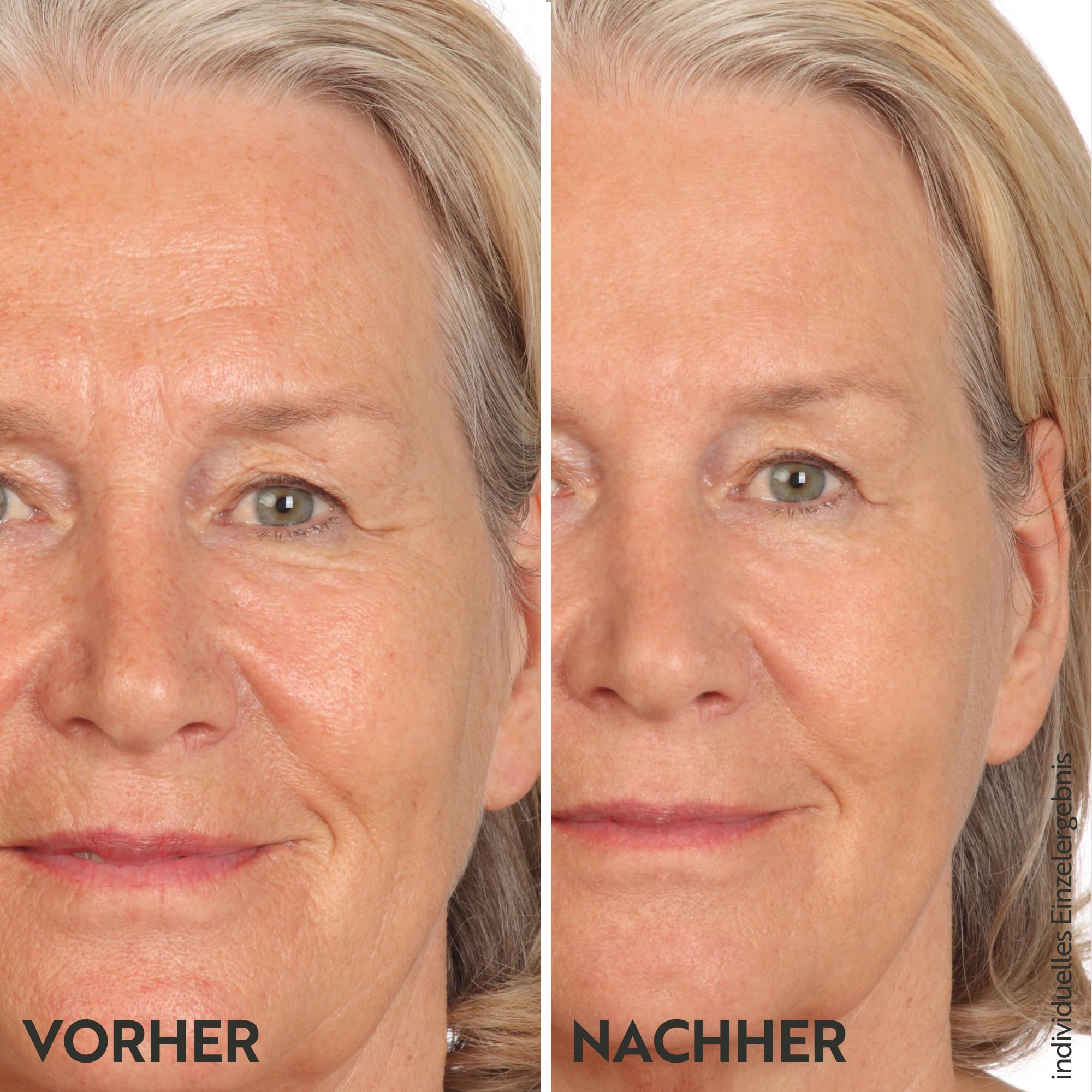 m-asam-vinolift-straffungscreme-100ml-gesichtspflege image 5