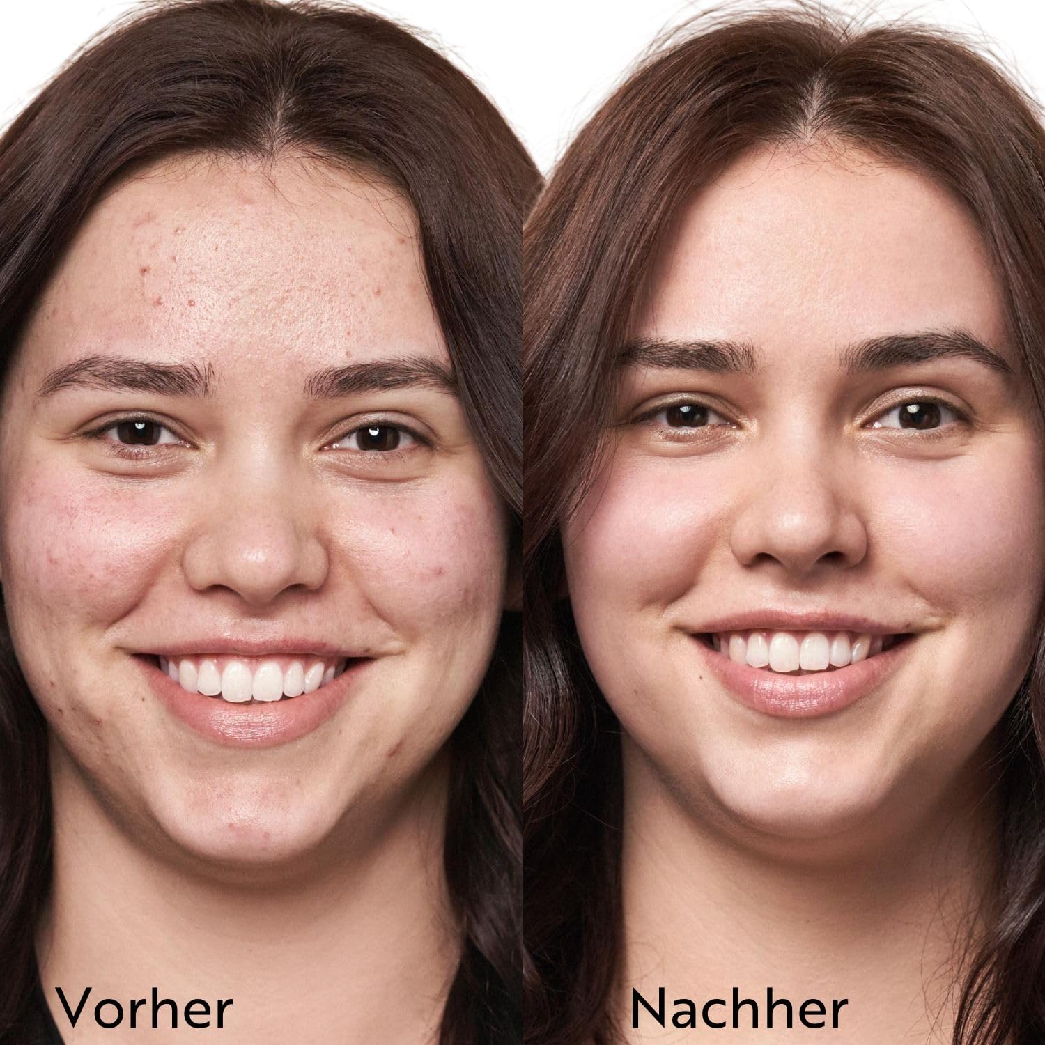 m-asam-clear-skin-discovery-set-4-teilig-unreine-haut image 3