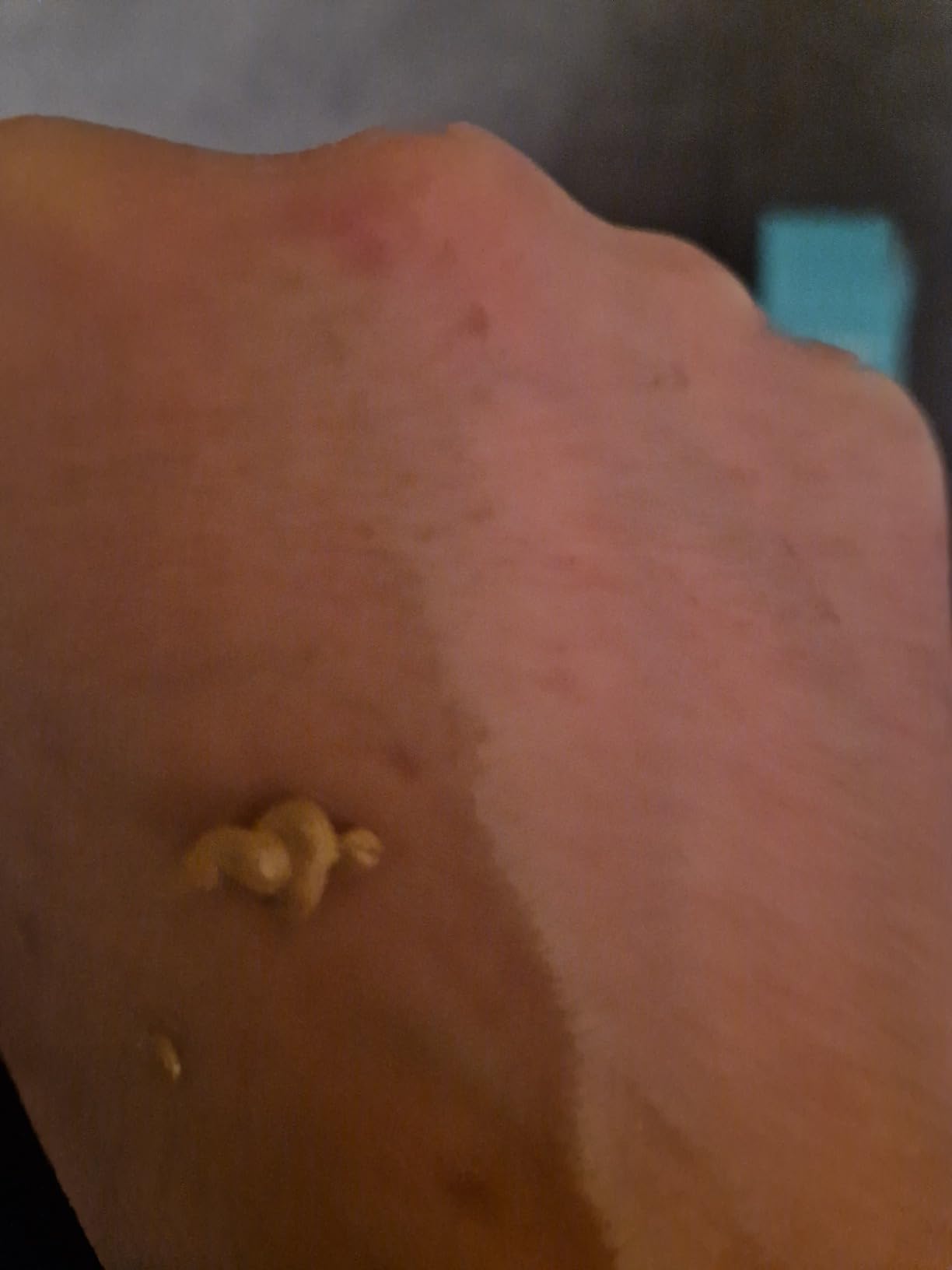 Meine Sommer Foundation